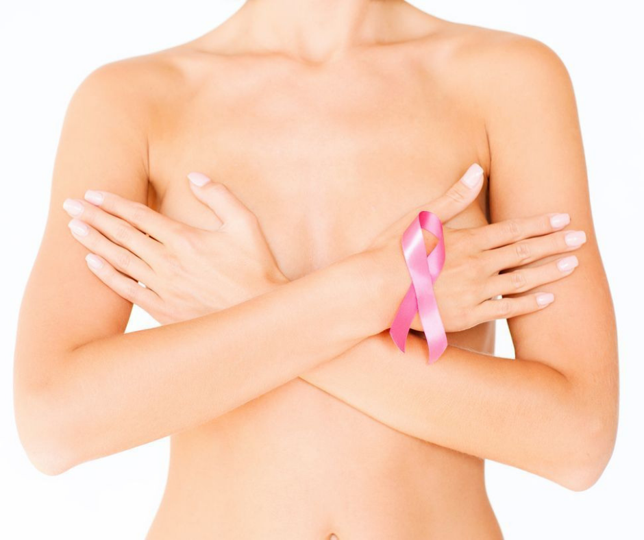 Retirada do seio pós-câncer: como se recuperar da mastectomia